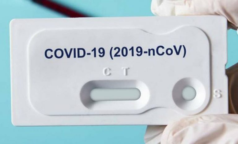 Biaya Rapid Test Tak Boleh Lebih Dari Rp.150 Ribu